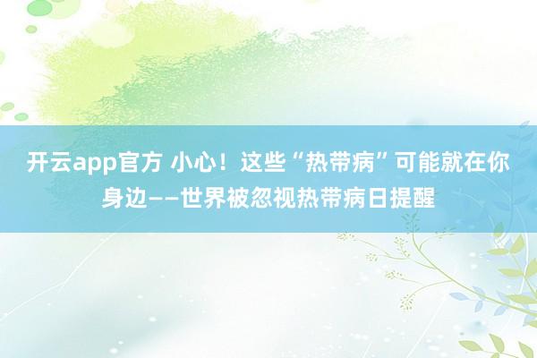 开云app官方 小心!这些“热带病”可能就在你身边——世界被忽视热带病日提醒